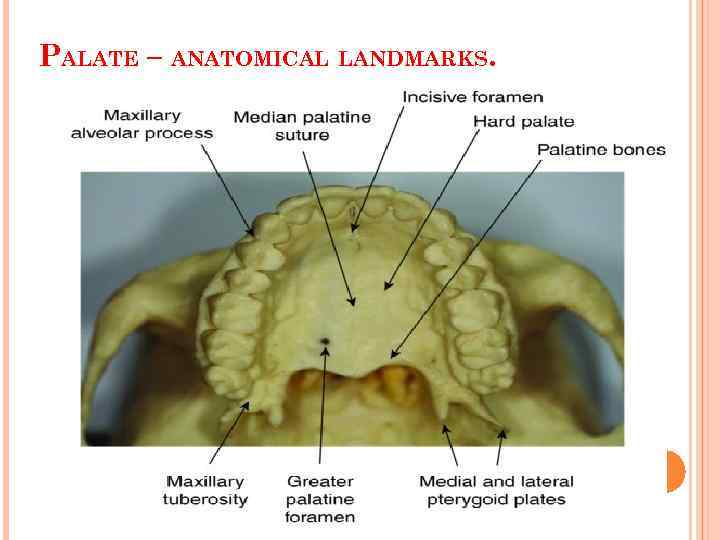 PALATE – ANATOMICAL LANDMARKS. 