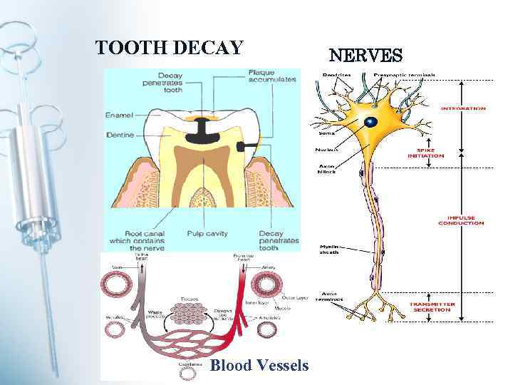 TOOTH DECAY Blood Vessels NERVES 