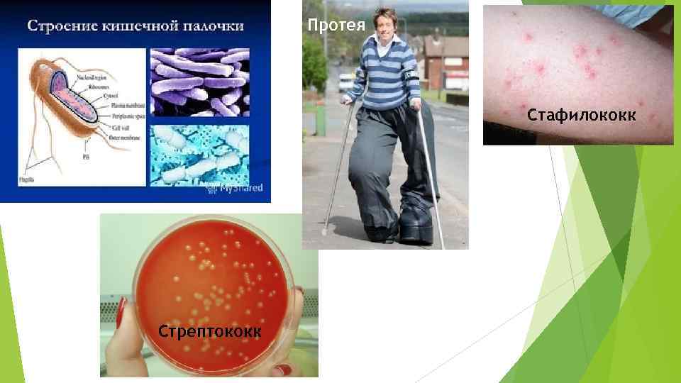 Протея Стафилококк Стрептококк 