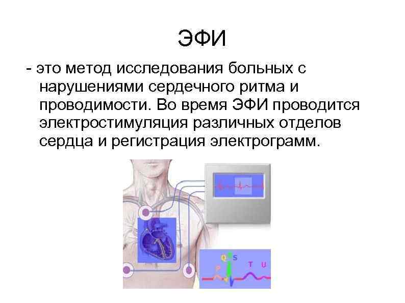 Эфи. Электрофизиологическое исследование сердца (эфи). Эфи метод исследования сердца. Электрофизиологическое исследование сердца нормы. Внутрисердечное электрофизиологическое исследование сердца (эфи).