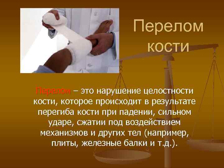 Перелом кости Перелом – это нарушение целостности кости, которое происходит в результате перегиба кости