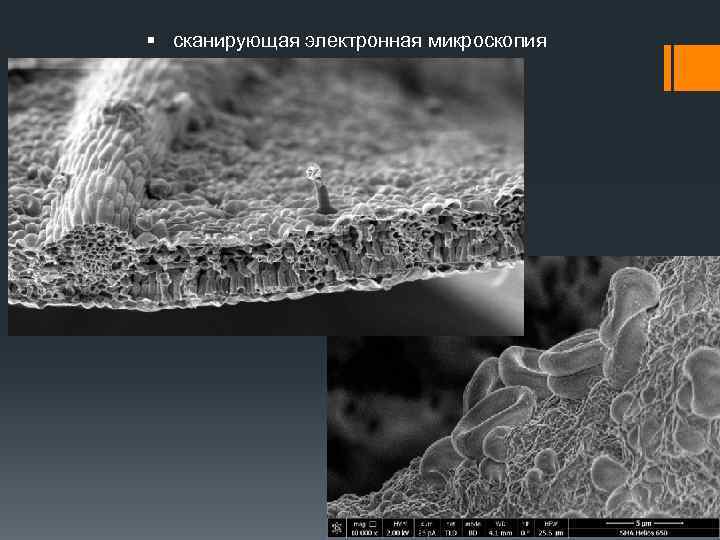 Электронный микроскоп фото с подписями