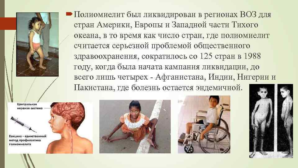  Полиомиелит был ликвидирован в регионах ВОЗ для стран Америки, Европы и Западной части