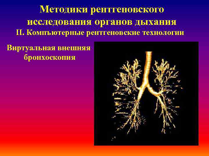 Методики рентгеновского исследования органов дыхания ІІ. Компъютерные рентгеновские технологии Виртуальная внешняя бронхоскопия 