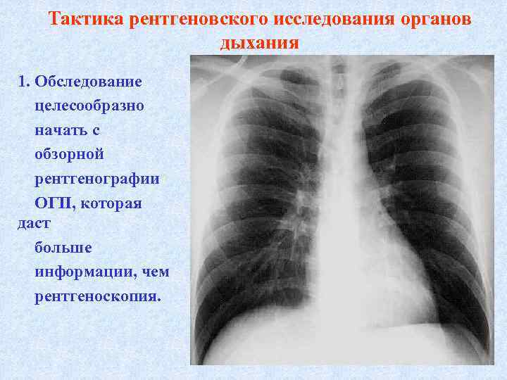 Тактика рентгеновского исследования органов дыхания 1. Обследование целесообразно начать с обзорной рентгенографии ОГП, которая
