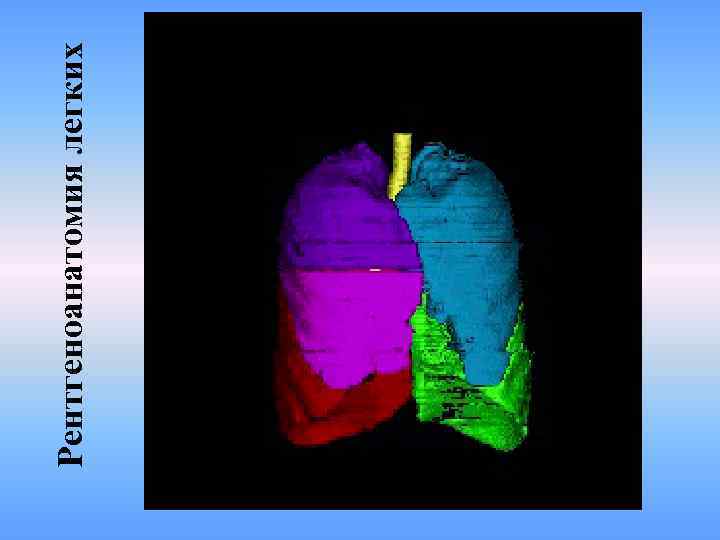 Рентгеноанатомия легких 