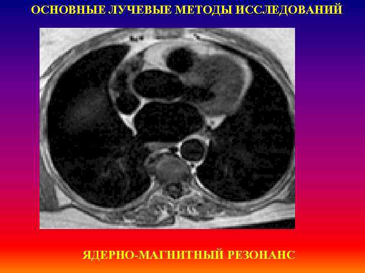 ОСНОВНЫЕ ЛУЧЕВЫЕ МЕТОДЫ ИССЛЕДОВАНИЙ ЯДЕРНО-МАГНИТНЫЙ РЕЗОНАНС 