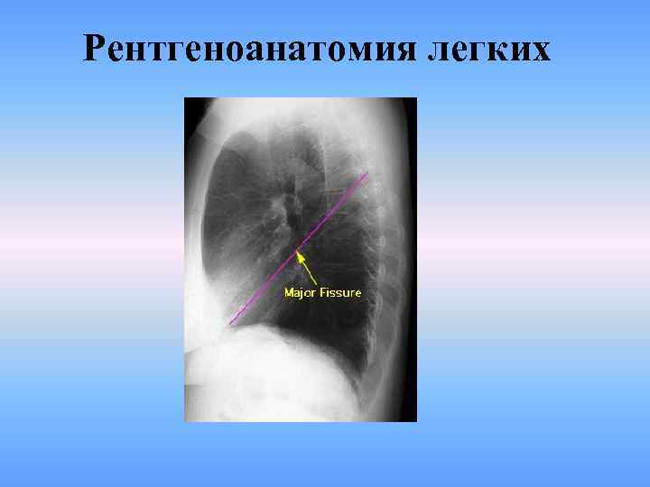 Рентгеноанатомия легких 