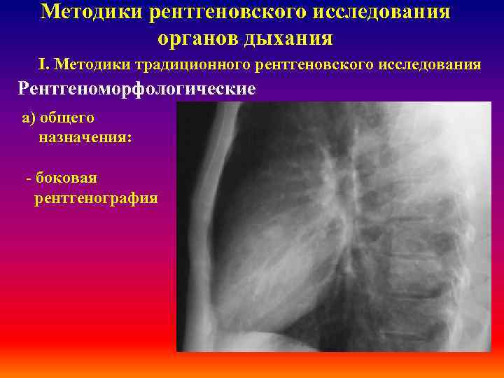 Методики рентгеновского исследования органов дыхания І. Методики традиционного рентгеновского исследования Рентгеноморфологические а) общего назначения: