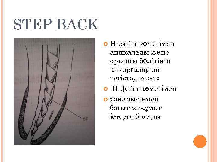 STEP BACK Н-файл көмегімен апикальды және ортаңғы бөлігінің қабырғаларын тегістеу керек Н-файл көмегімен жоғары-төмен