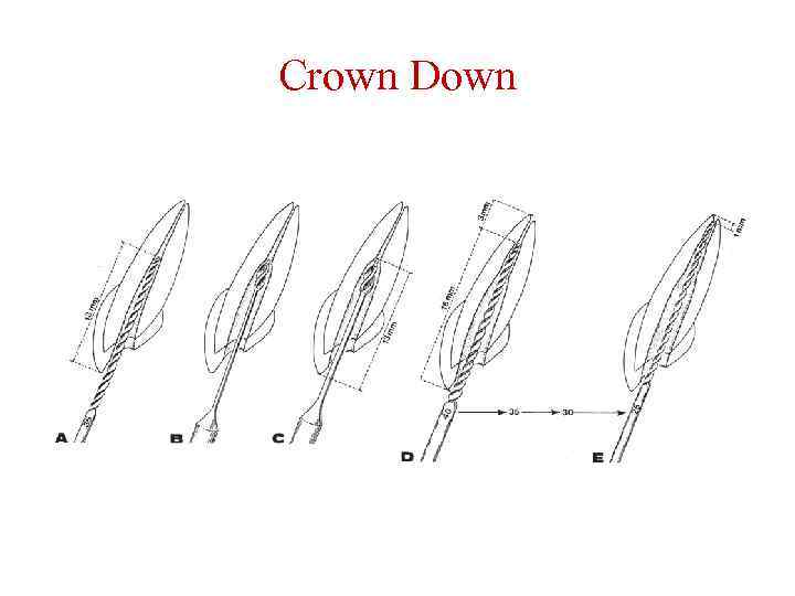 Crown Down 