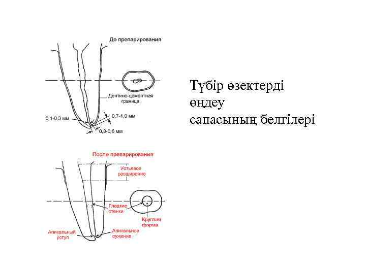 Түбір өзектерді өңдеу сапасының белгілері 