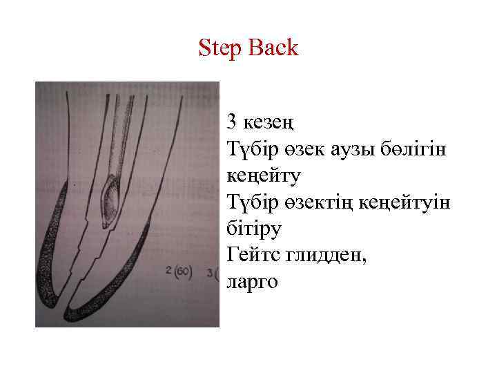 Step Back 3 кезең Түбір өзек аузы бөлігін кеңейту Түбір өзектің кеңейтуін бітіру Гейтс