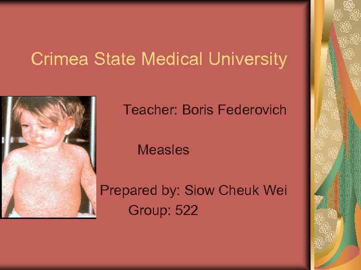 Crimea State Medical University Teacher: Boris Federovich Measles Prepared by: Siow Cheuk Wei Group: