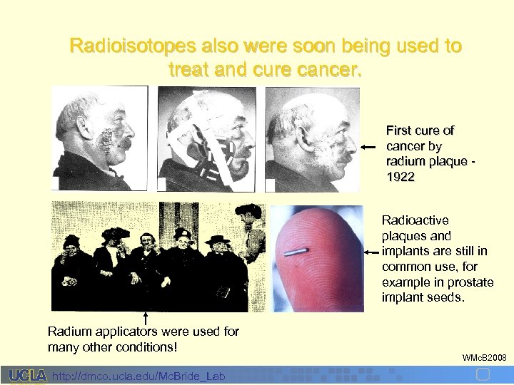 Radioisotopes also were soon being used to treat and cure cancer. First cure of