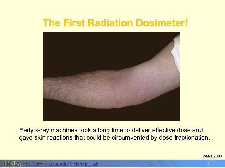 The First Radiation Dosimeter! Early x-ray machines took a long time to deliver effective