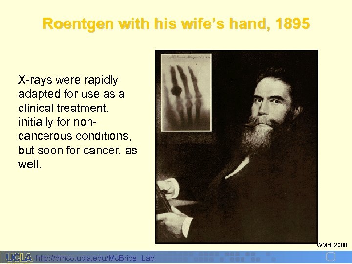 Roentgen with his wife’s hand, 1895 X-rays were rapidly adapted for use as a