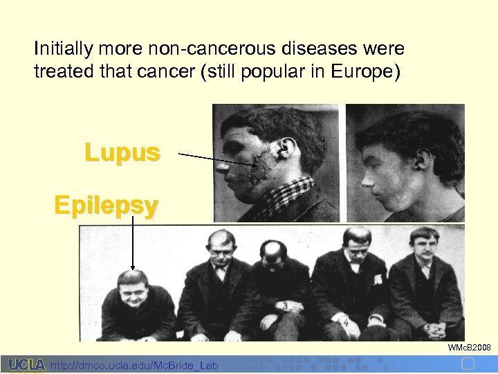 Initially more non-cancerous diseases were treated that cancer (still popular in Europe) Lupus Epilepsy