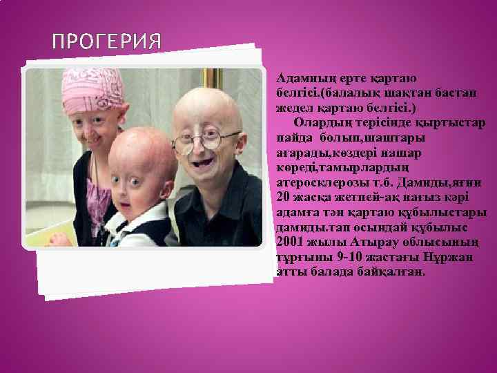 ПРОГЕРИЯ Адамның ерте қартаю белгісі. (балалық шақтан бастап жедел қартаю белгісі. ) Олардың терісінде