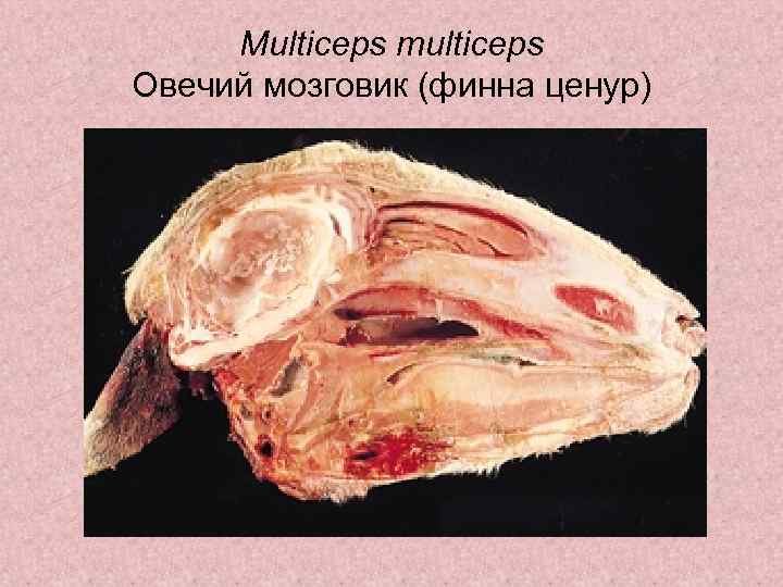 Multiceps multiceps Овечий мозговик (финна ценур) 