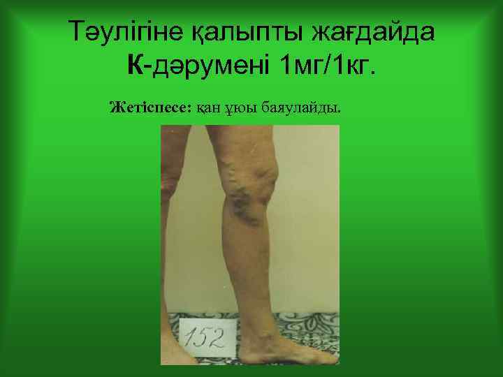 Тәулігіне қалыпты жағдайда К-дәрумені 1 мг/1 кг. Жетіспесе: қан ұюы баяулайды. 