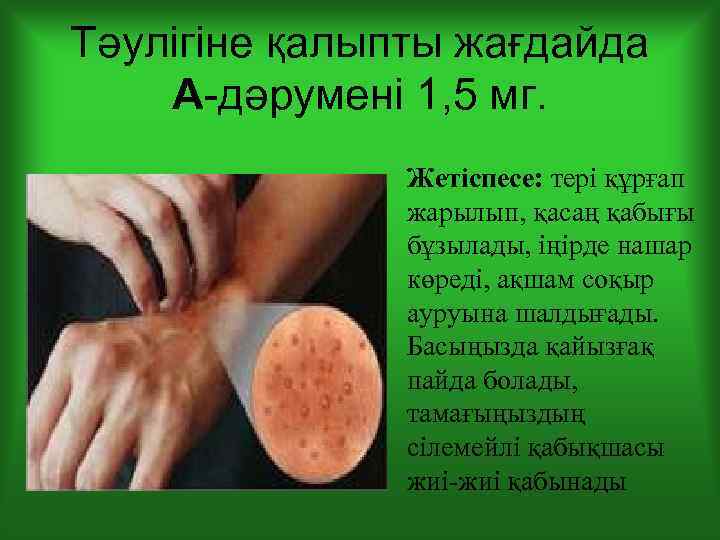 Тәулігіне қалыпты жағдайда А-дәрумені 1, 5 мг. Жетіспесе: тері құрғап жарылып, қасаң қабығы бұзылады,