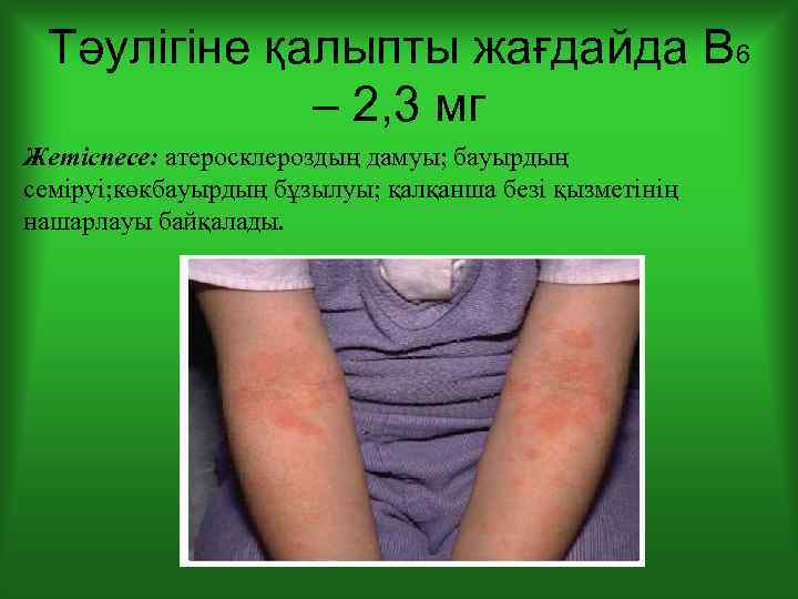 Тәулігіне қалыпты жағдайда В 6 – 2, 3 мг Жетіспесе: атеросклероздың дамуы; бауырдың семіруі;