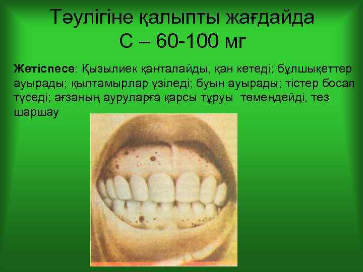 Тәулігіне қалыпты жағдайда С – 60 -100 мг Жетіспесе: Қызылиек қанталайды, қан кетеді; бұлшықеттер