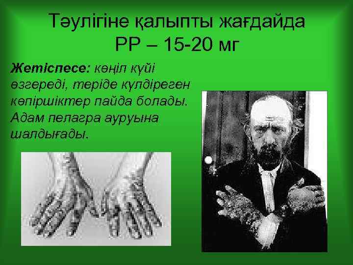 Тәулігіне қалыпты жағдайда РР – 15 -20 мг Жетіспесе: көңіл күйі өзгереді, теріде күлдіреген
