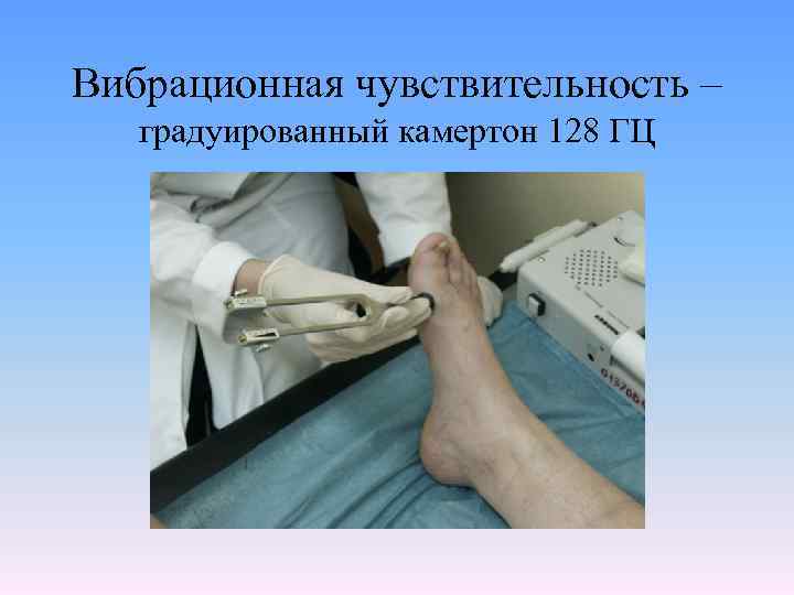 Вибрационная чувствительность – градуированный камертон 128 ГЦ 