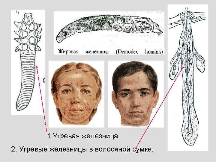 1. Угревая железница 2. Угревые железницы в волосяной сумке. 