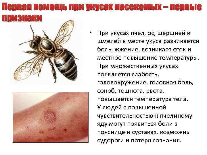 Первая помощь при укусах насекомых – первые признаки • При укусах пчел, ос, шершней