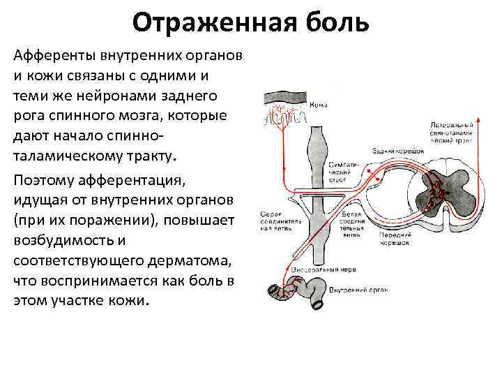 Механизм физиология. Механизм формирования отраженной боли. Механизм возникновения отражённых болей. Отраженная боль физиология. Схема формирования отраженной боли.