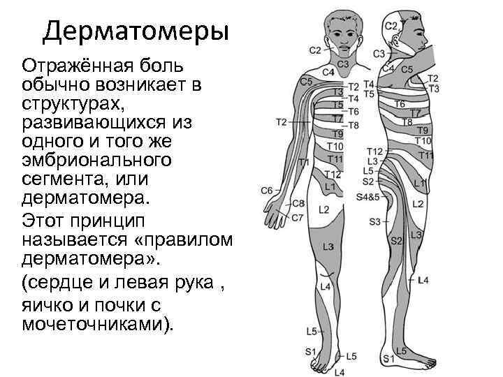 Дерматомеры Отражённая боль обычно возникает в структурах, развивающихся из одного и того же эмбрионального