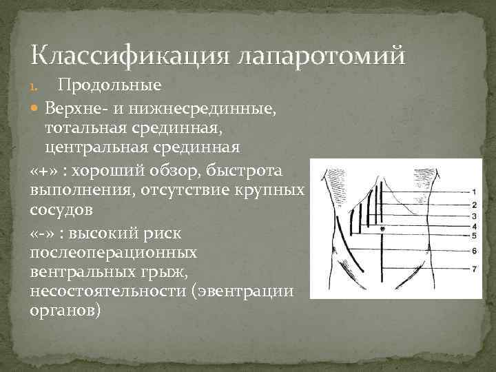 Классификация лапаротомий Продольные Верхне- и нижнесрединные, тотальная срединная, центральная срединная «+» : хороший обзор,