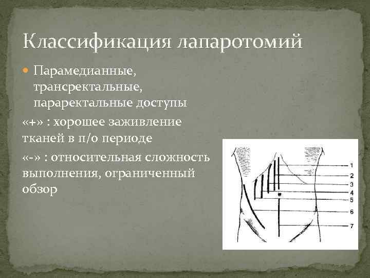 Классификация лапаротомий Парамедианные, трансректальные, параректальные доступы «+» : хорошее заживление тканей в п/о периоде