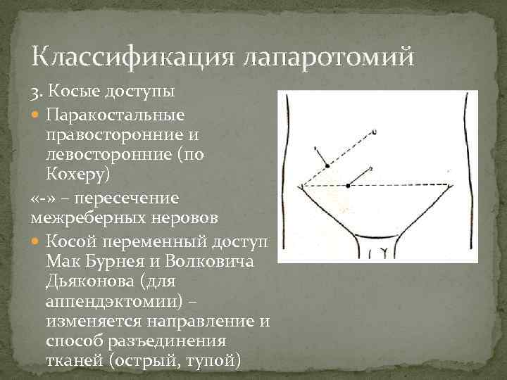 Классификация лапаротомий 3. Косые доступы Паракостальные правосторонние и левосторонние (по Кохеру) «-» – пересечение