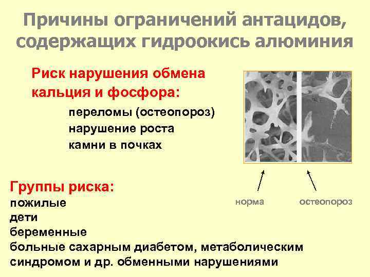 Причины ограничений антацидов, содержащих гидроокись алюминия Риск нарушения обмена кальция и фосфора: переломы (остеопороз)