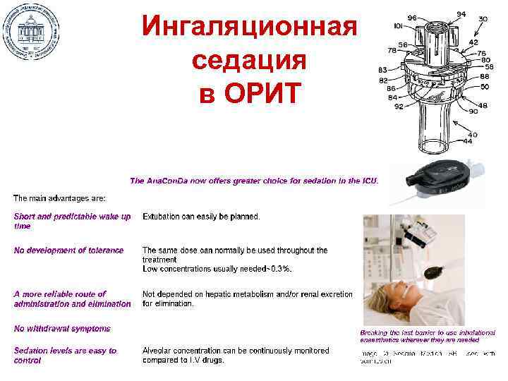 Ингаляционная седация в ОРИТ 