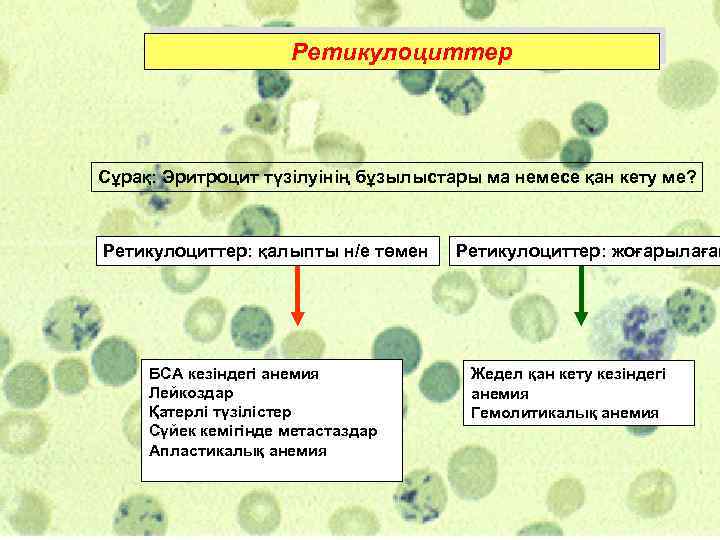 Ретикулоциттер Сұрақ: Эритроцит түзілуінің бұзылыстары ма немесе қан кету ме? Ретикулоциттер: қалыпты н/е төмен