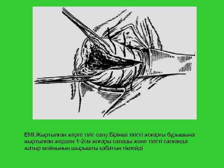 ЕМІ. Жыртылған жерге тігіс салу. Бірінші тігісті жоғарғы бұрышына жыртылған жерден 1 2 см