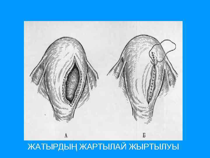 ЖАТЫРДЫҢ ЖАРТЫЛАЙ ЖЫРТЫЛУЫ 