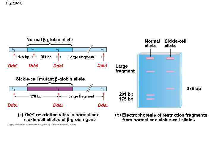 Fig. 20 -10 Normal -globin allele 175 bp Dde. I Sickle-cell allele Large fragment
