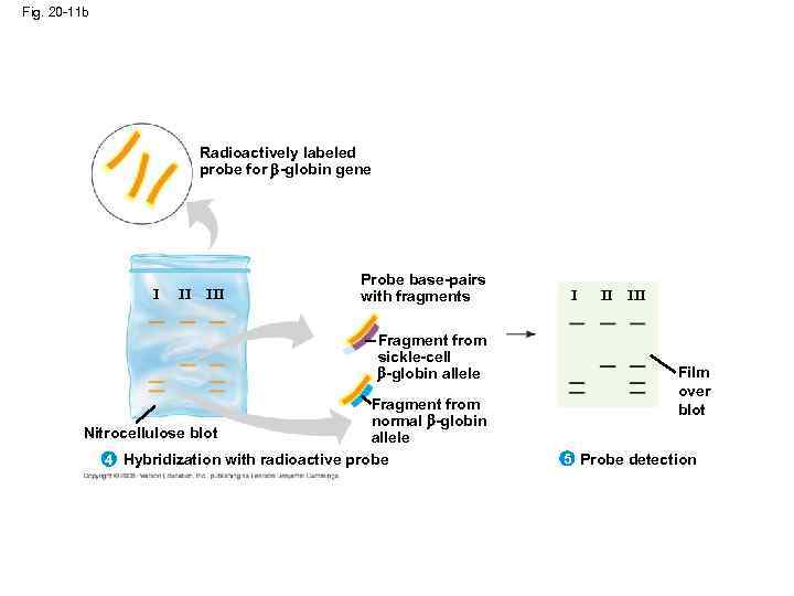 Fig. 20 -11 b Radioactively labeled probe for -globin gene I II III Probe
