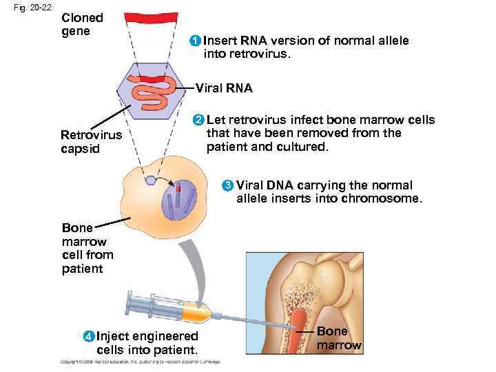 Fig. 20 -22 Cloned gene 1 Insert RNA version of normal allele into retrovirus.