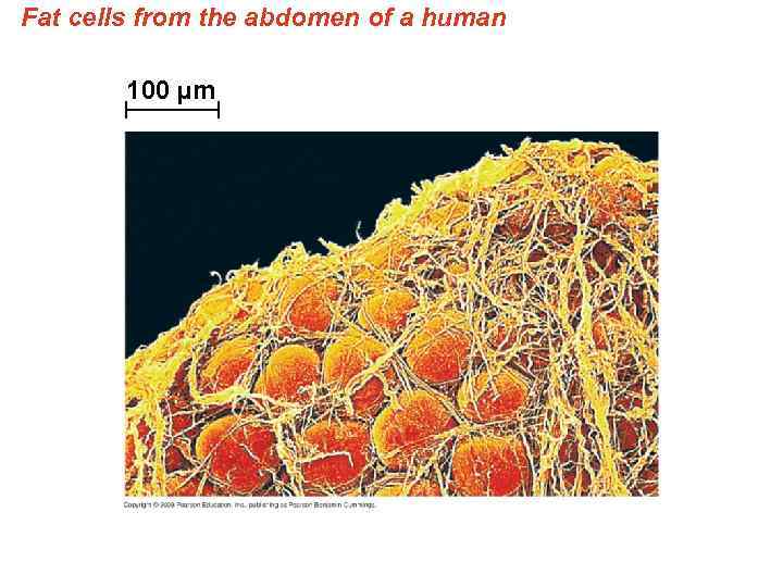 Fat cells from the abdomen of a human 100 µm 