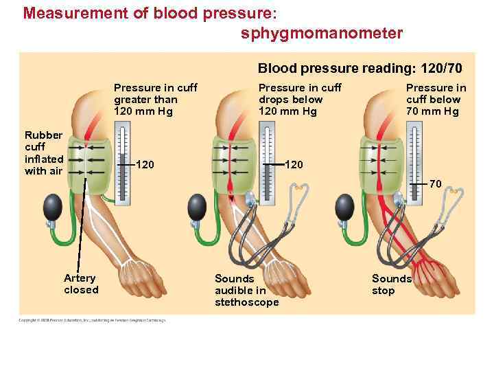 Measurement of blood pressure: sphygmomanometer Blood pressure reading: 120/70 Pressure in cuff greater than