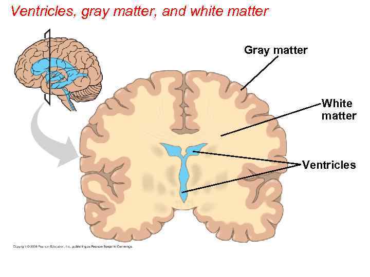 Ventricles, gray matter, and white matter Gray matter White matter Ventricles 