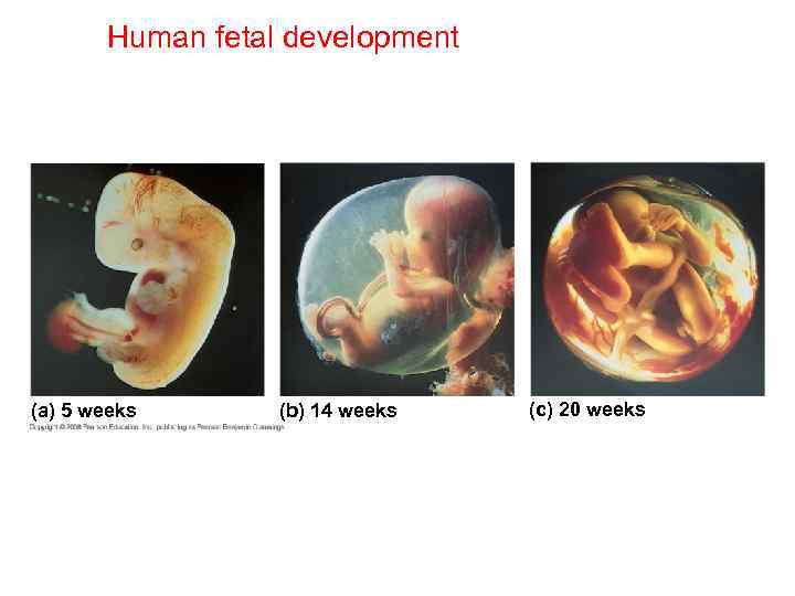 Human fetal development (a) 5 weeks (b) 14 weeks (c) 20 weeks 