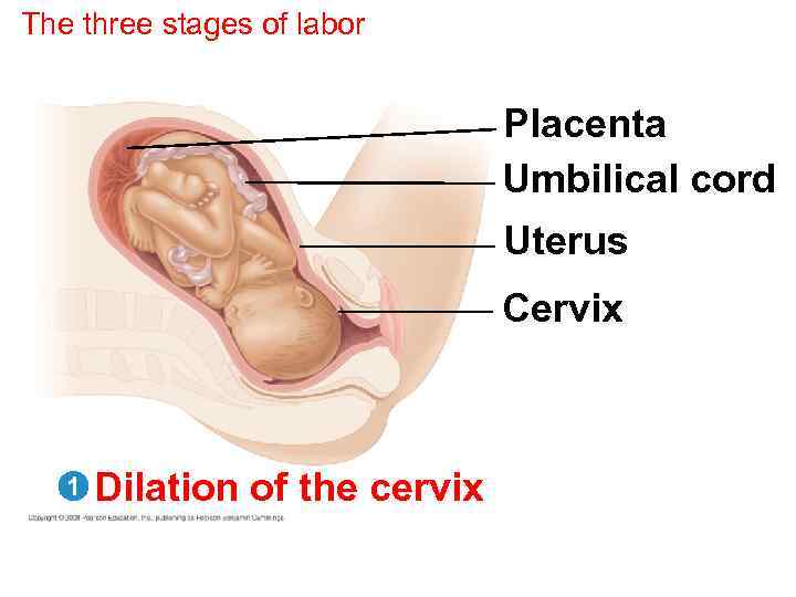 The three stages of labor Placenta Umbilical cord Uterus Cervix 1 Dilation of the